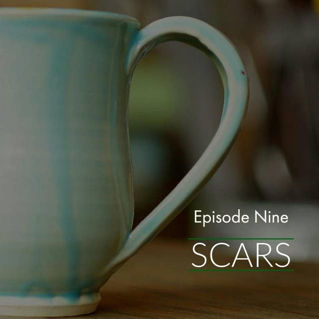 Episode 9: Scars