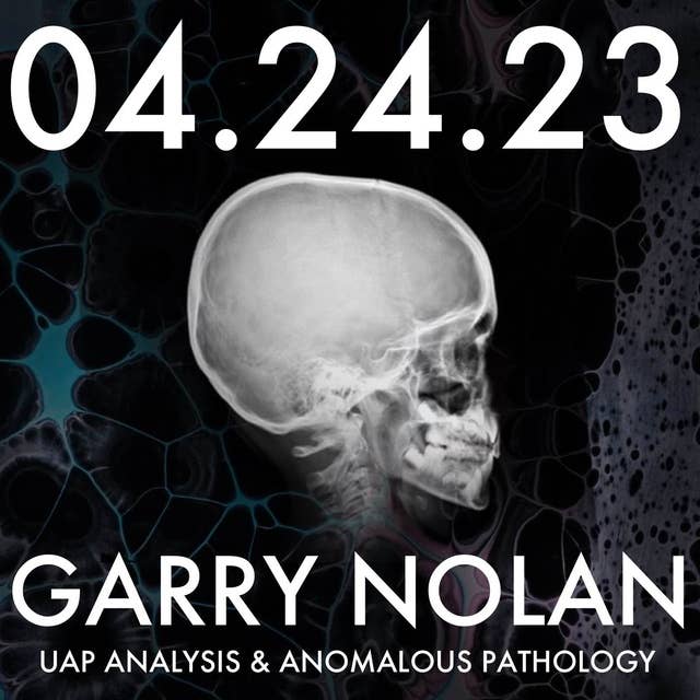 Garry Nolan: UAP Analysis and Anomalous Pathology | MHP 04.19.23.