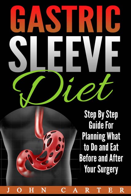 Gastric Sleeve Diet: Step By Step Guide For Planning What to Do and Eat Before and After Your Surgery