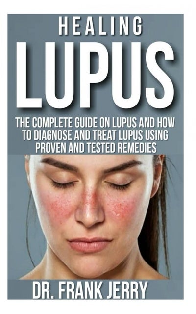 Healing Lupus: The Complete Guide On Lupus And How To Diagnose And ...