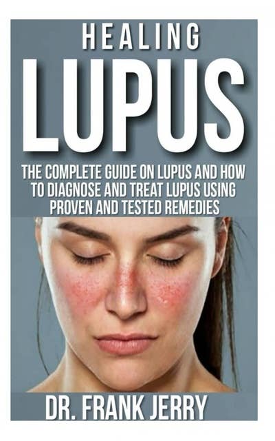 Healing Lupus: The Complete Guide on Lupus and How to diagnose and Treat Lupus using Proven and Tested Remedies