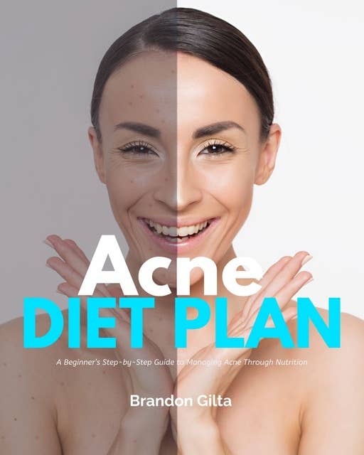 Acne Diet Plan: A Beginner’s Step-by-Step Guide to Managing Acne Through Nutrition With Curated Recipes and a Sample Meal Plan