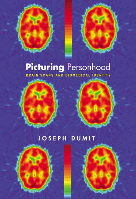 Picturing Personhood: Brain Scans and Biomedical Identity