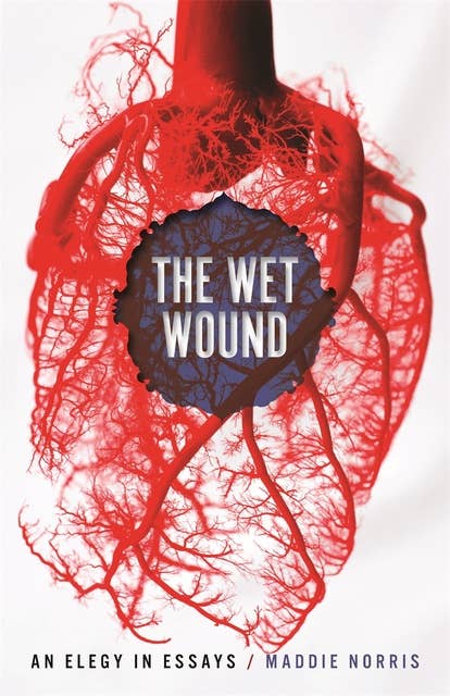 The Wet Wound: An Elegy in Essays