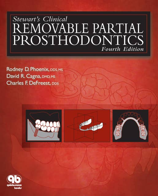 Stewart's Clinical Removable Partial Prosthodontics: Fourth Edition