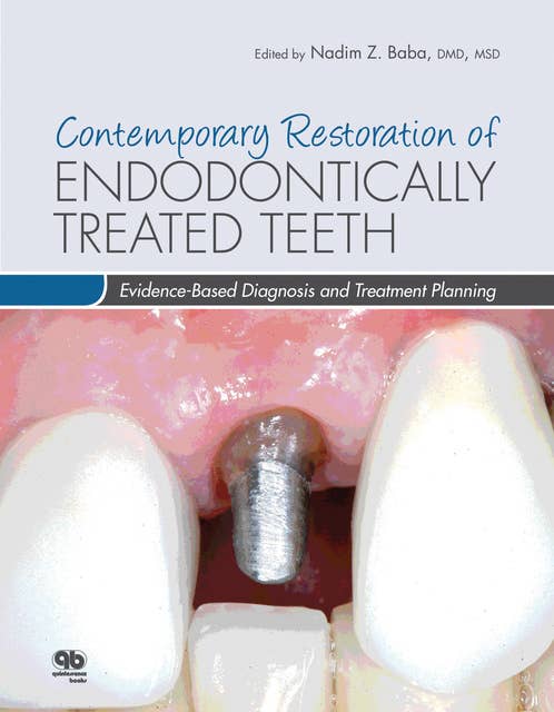 Contemporary Restoration of Endodontically Treated Teeth: Evidence-Based Diagnosis and Treatment Planning
