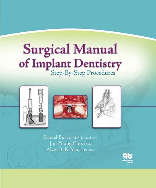 Surgical Manual of Implant Dentistry: Step-by-Step Procedures