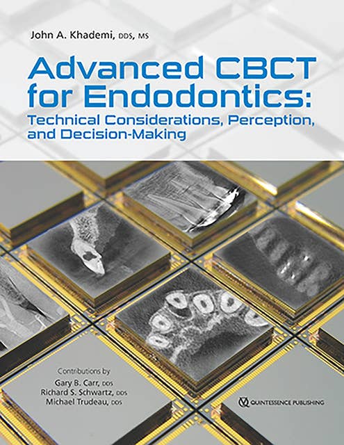 Advanced CBCT for Endodontics: Technical Considerations, Perception, and Decision-Making