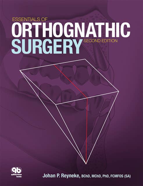 Essentials of Orthognathic Surgery: Second Edition
