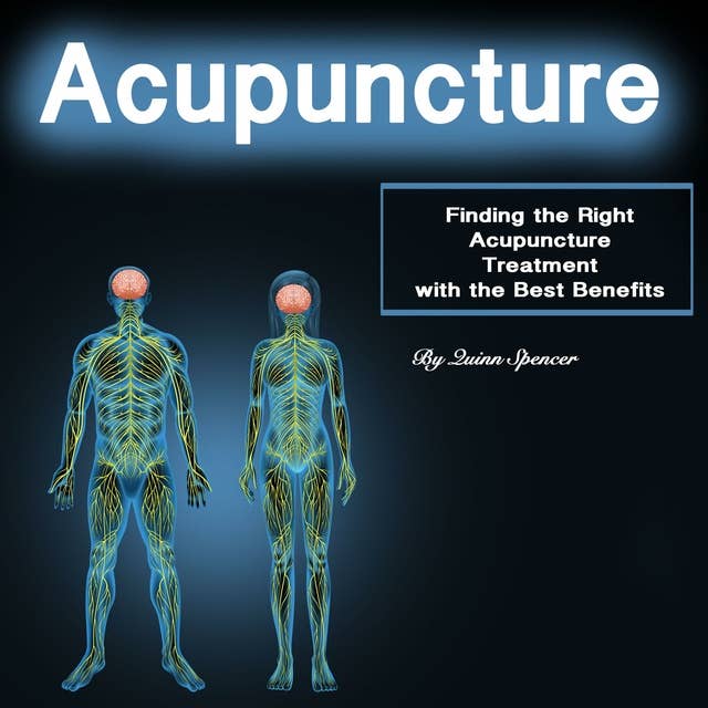 Acupuncture: Finding the Right Acupuncture Treatment with the Best Benefits