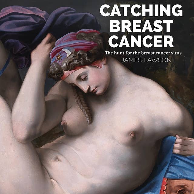 Catching Breast Cancer: The hunt for the breast cancer virus
