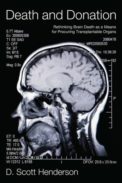 Death and Donation: Rethinking Brain Death as a Means for Procuring Transplantable Organs
