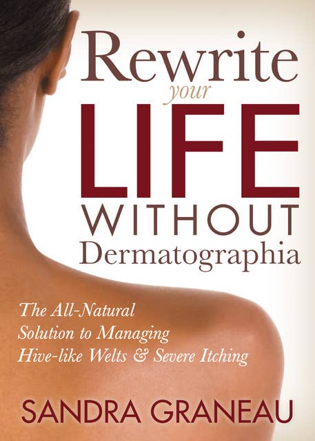 Rewrite Your Life Without Dermatographia: The All-Natural Solution to Managing Hive-like Welts & Severe Itching