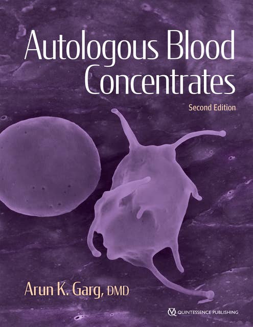 Autologous Blood Concentrates: Second Edition