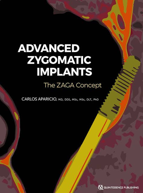 Zygomatic Implants: The Anatomy Guided Approach
