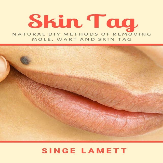 Skin Tag: Natural DIY Methods of removing Mole, Wart and Skin Tag