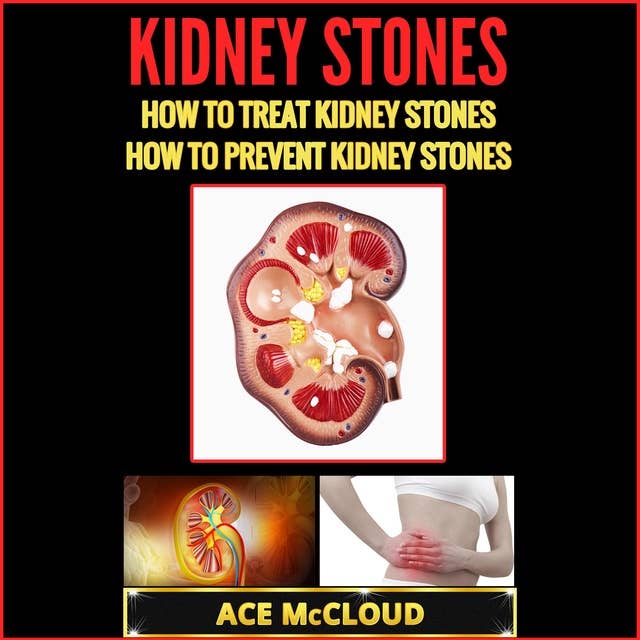 Kidney Stones: How To Treat Kidney Stones: How To Prevent Kidney Stones