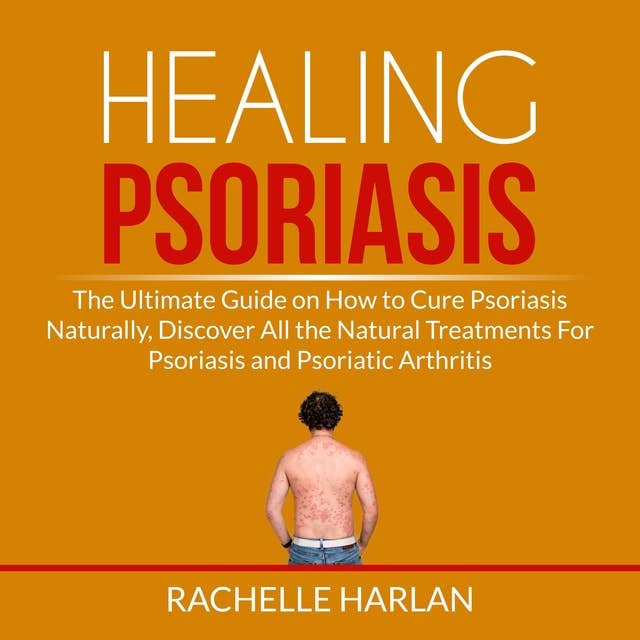 Healing Psoriasis: The Ultimate Guide on How to Cure Psoriasis Naturally, Discover All the Natural Treatments For Psoriasis and Psoriatic Arthritis