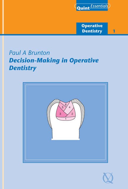 Decision-Making in Operative Dentistry