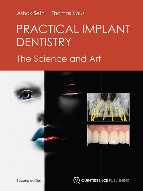 Practical Implant Dentistry: The Science and Art