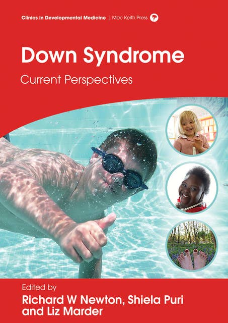 Down Syndrome: Current Perspectives