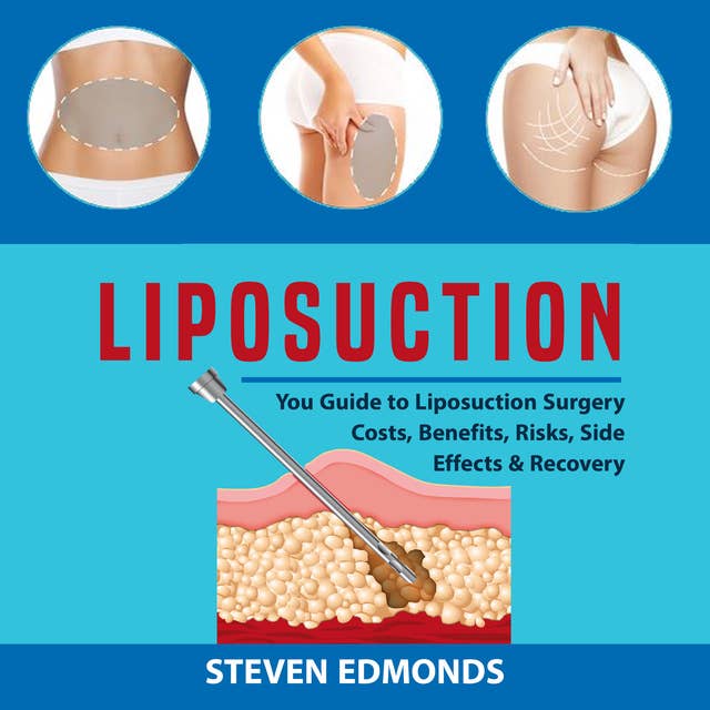 Liposuction: You Guide to Liposuction Surgery Costs, Benefits, Risks, Side Effects & Recovery