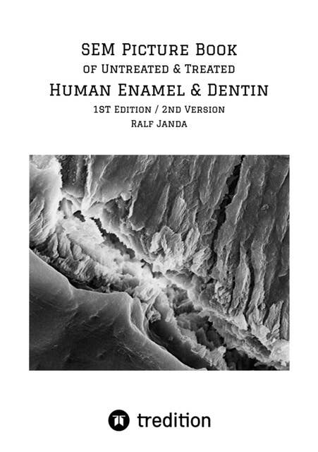 SEM Picture Book of Untreated & Treated Human Enamel & Dentin: High Resolution Scanning Electron Microscopic Pictures of Human Enamel & Dentin