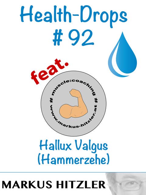 Health-Drops #092: Hallux Valgus (Hammerzehe)