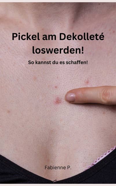 Pickel am Dekolleté loswerden!: So kannst du es schaffen!