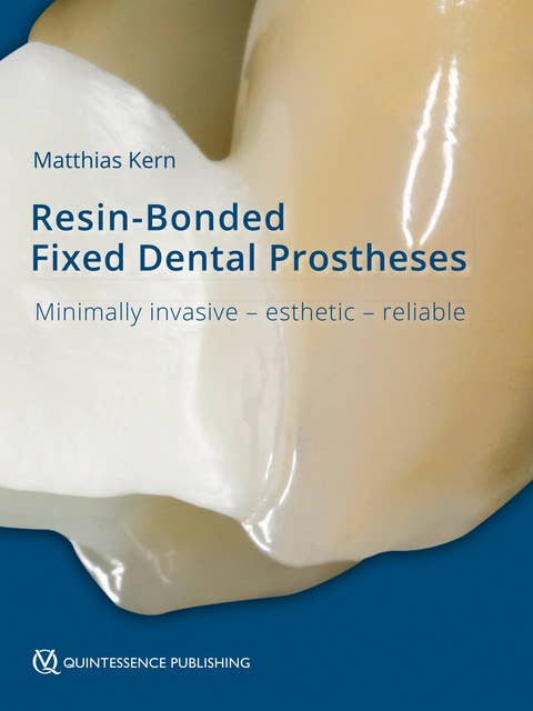 Resin-Bonded Fixed Dental Prostheses: Minimally invasive – esthetic – reliable