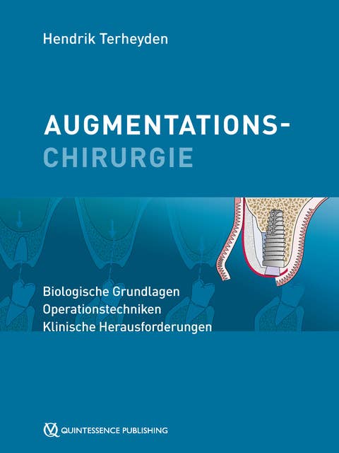 Augmentationschirurgie: Biologische Grundlagen, Operationstechniken, Klinische Herausforderungen