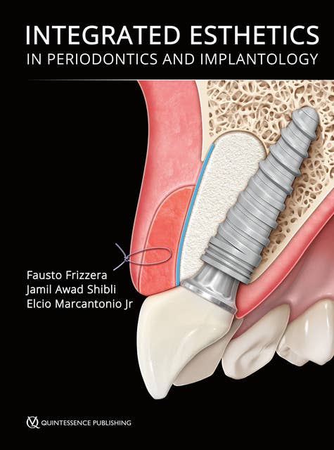 Integrated Esthetics in Periodontics and Implantology