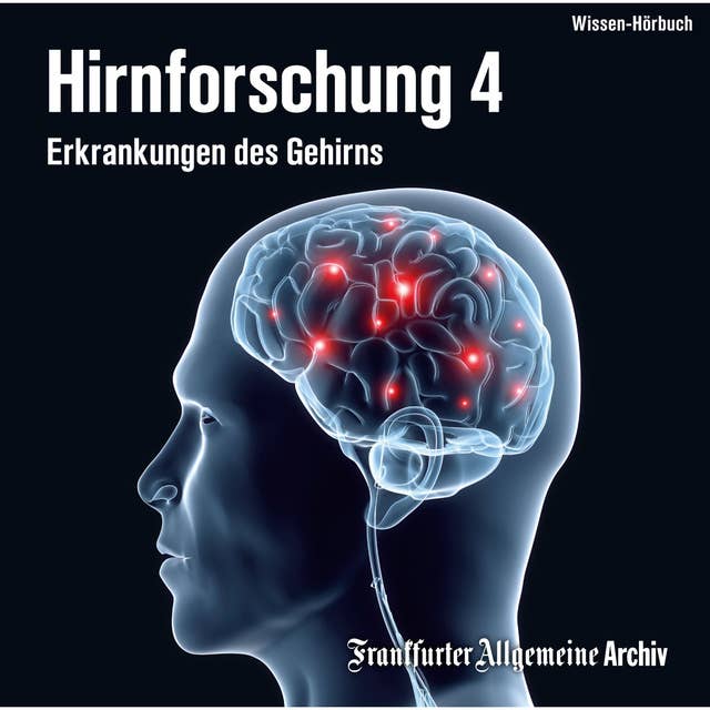 Hirnforschung - Band 4: Erkrankungen des Gehirns
