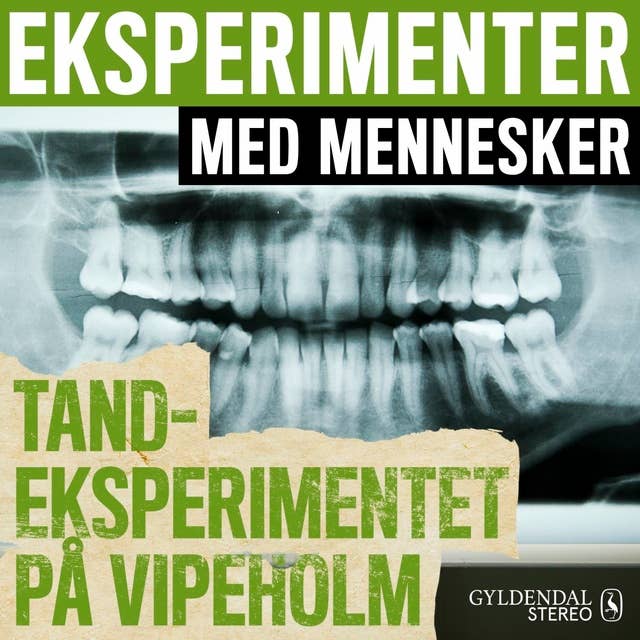 Cover for Eksperimenter med mennesker - Tandeksperimentet på Vipeholm