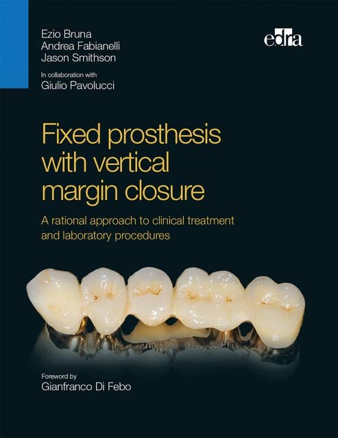 Fixed prosthesis with vertical margin closure: Integration between function and aesthetics