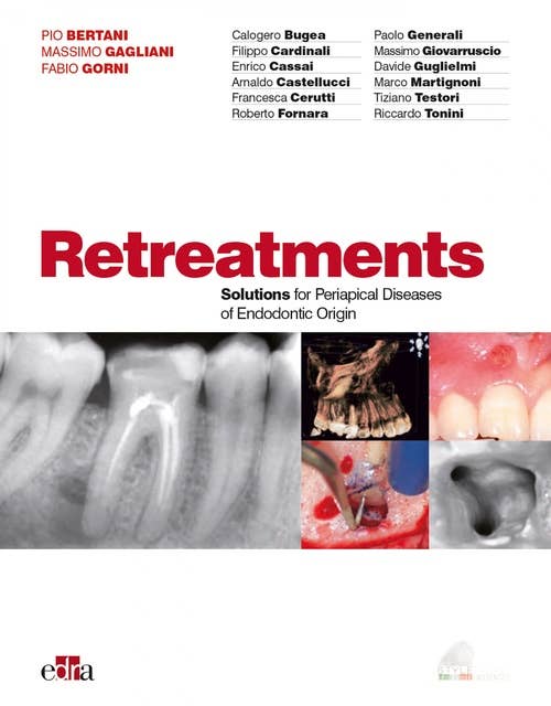 Retreatments: Solutions for apical diseases of endodontic origin