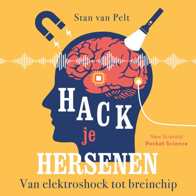Hack je hersenen: Van elektroshock tot breinchip