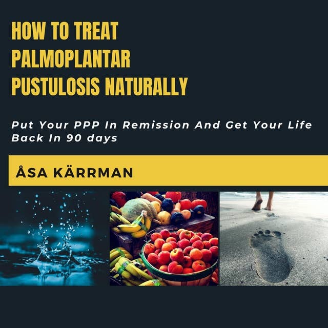 How To Treat Palmoplantar Pustulosis Naturally: Put Your PPP In Remission And Get Your Life Back in 90 days