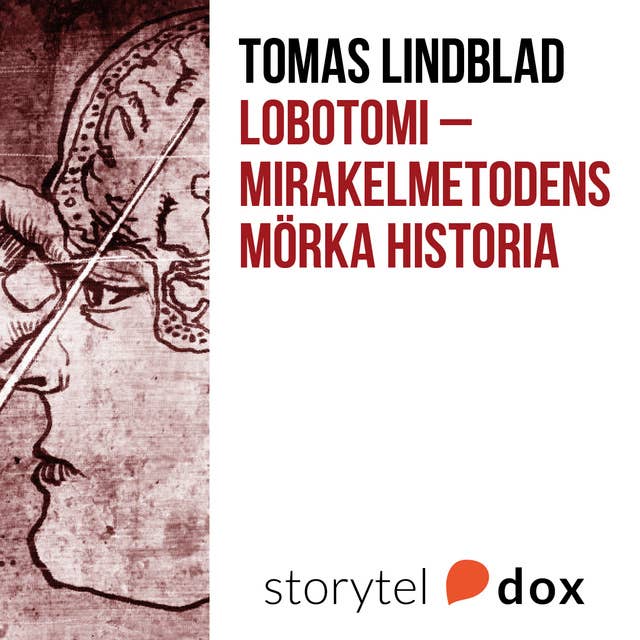 Lobotomi - Mirakelmetodens mörka historia
