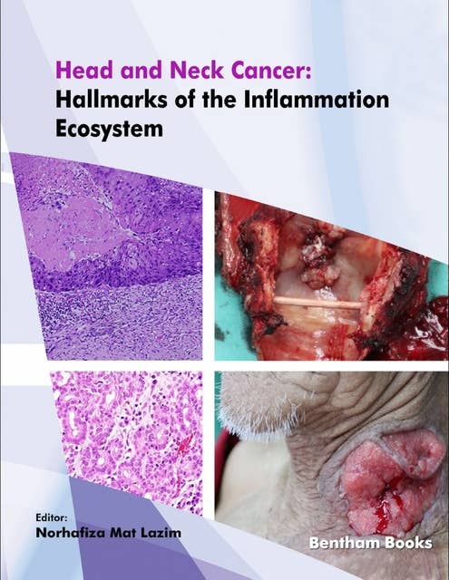 Head and Neck Cancer: Hallmarks of the Inflammation Ecosystem