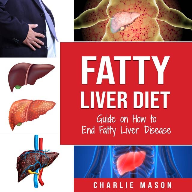 Fatty Liver Diet: Guide on How to End Fatty Liver Disease Fatty Liver Diet Books: Fatty Liver Diet